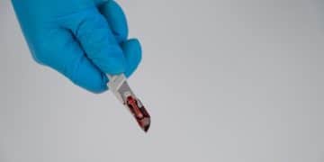 Guia Definitivo: Entenda Seus Exames de Sangue e Cuide da Saúde - Cover Image
