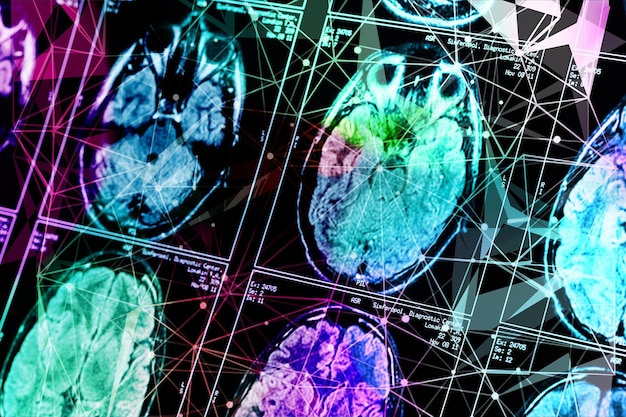A close-up shot of brain scans showing increased activity in areas associated with memory and cognitive function after a period of regular physical exercise. The scans should be colorful and detailed, illustrating the scientific evidence of the positive impact of exercise on brain health.