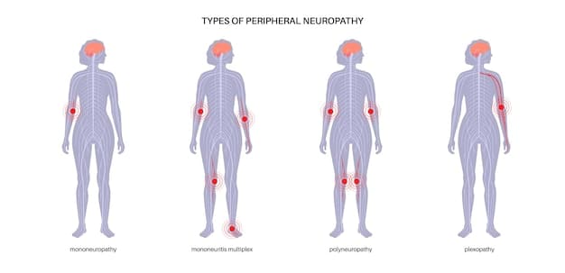 An illustration showing different types of back pain, highlighting the affected areas and potential underlying causes.